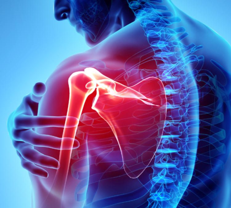 When Is Shoulder Replacement Surgery A good Option?